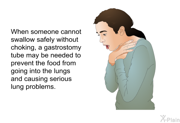 When someone cannot swallow safely without choking, a gastrostomy tube may be needed to prevent the food from going into the lungs and causing serious lung problems.