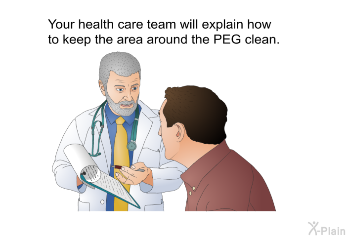 Your health care team will explain how to keep the area around the PEG clean.