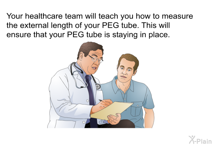 Your healthcare team will teach you how to measure the external length of your PEG tube. This will ensure that your PEG tube is staying in place.