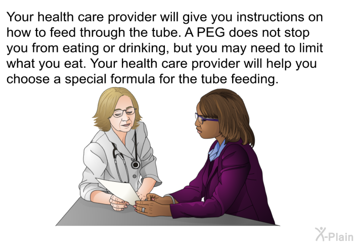 Your health care provider will give you instructions on how to feed through the tube. A PEG does not stop you from eating or drinking, but you may need to limit what you eat. Your health care provider will help you choose a special formula for the tube feeding.
