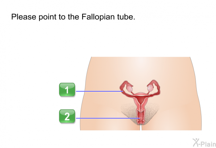 Please point to the Fallopian tube.