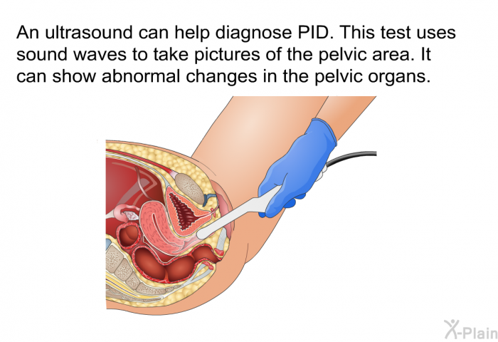 An ultrasound can help diagnose PID. This test uses sound waves to take pictures of the pelvic area. It can show abnormal changes in the pelvic organs.