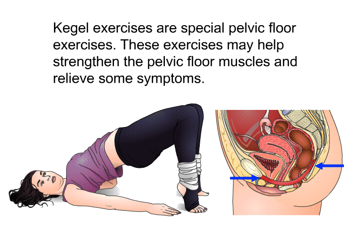 Kegel exercises are special pelvic floor exercises. These exercises may help strengthen the pelvic floor muscles and relieve some symptoms.