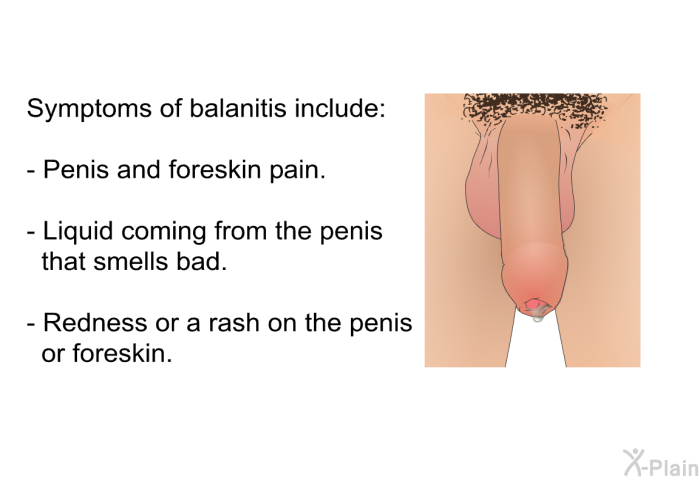Symptoms of balanitis include:  Penis and foreskin pain. Liquid coming from the penis that smells bad. Redness or a rash on the penis or foreskin.