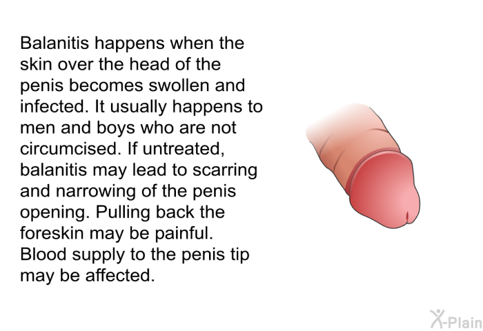 Balanitis happens when the skin over the head of the penis becomes swollen and infected. It usually happens to men and boys who are not circumcised. If untreated, balanitis may lead to scarring and narrowing of the penis opening. Pulling back the foreskin may be painful. Blood supply to the penis tip may be affected.