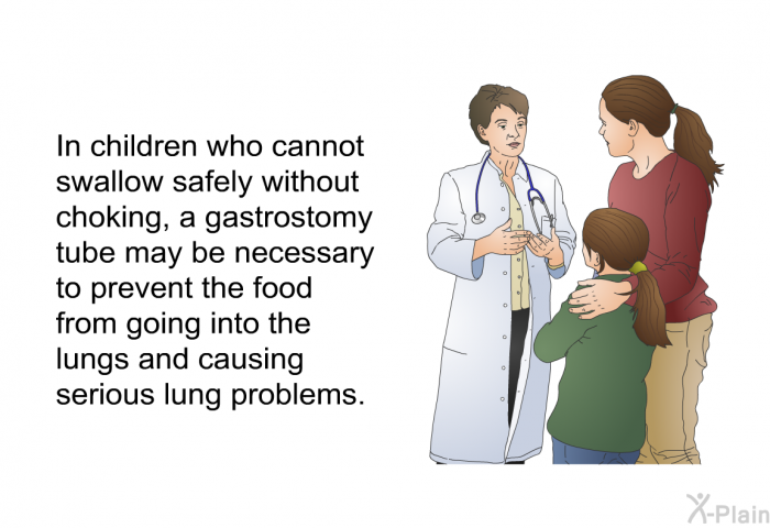 In children who cannot swallow safely without choking, a gastrostomy tube may be necessary to prevent the food from going into the lungs and causing serious lung problems.