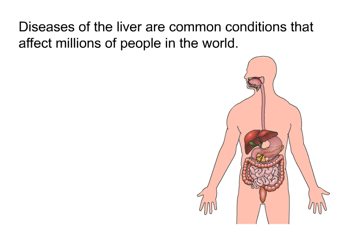 Diseases of the liver are common conditions that affect millions of people in the world.