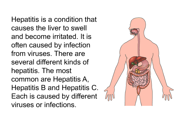 Hepatitis is a condition that causes the liver to swell and become irritated. It is often caused by infection from viruses. There are several different kinds of hepatitis. The most common are Hepatitis A, Hepatitis B and Hepatitis C. Each is caused by different viruses or infections.