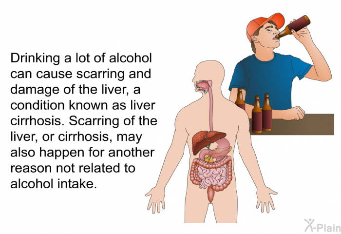 Drinking a lot of alcohol can cause scarring and damage of the liver, a condition known as liver cirrhosis. Scarring of the liver, or cirrhosis, may also happen for another reason not related to alcohol intake.
