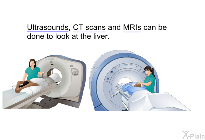 Ultrasounds, CT scans and MRIs can be done to look at the liver.