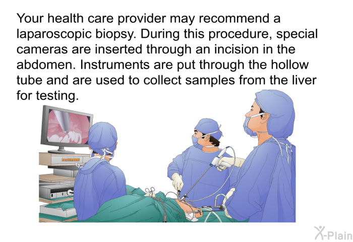 Your health care provider may recommend a laparoscopic biopsy. During this procedure, special cameras are inserted through an incision in the abdomen. Instruments are put through the hollow tube and are used to collect samples from the liver for testing.