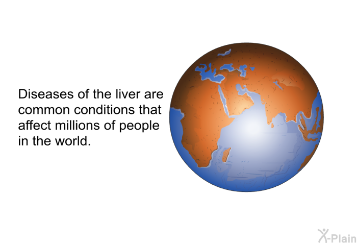 Diseases of the liver are common conditions that affect millions of people in the world.