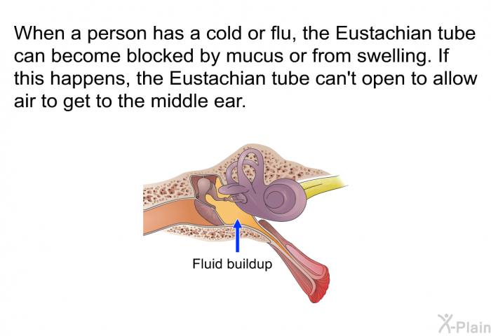 When a person has a cold or flu, the Eustachian tube can become blocked by mucus or from swelling. If this happens, the Eustachian tube can't open to allow air to get to the middle ear.