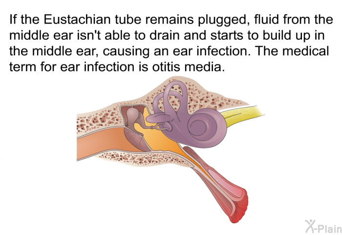 If the Eustachian tube remains plugged, fluid from the middle ear isn't able to drain and starts to build up in the middle ear, causing an ear infection. The medical term for ear infection is otitis media.
