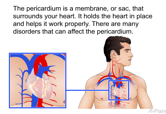 The pericardium is a membrane, or sac, that surrounds your heart. It holds the heart in place and helps it work properly. There are many disorders that can affect the pericardium.