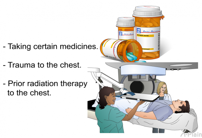 Taking certain medicines. Trauma to the chest. Prior radiation therapy to the chest.