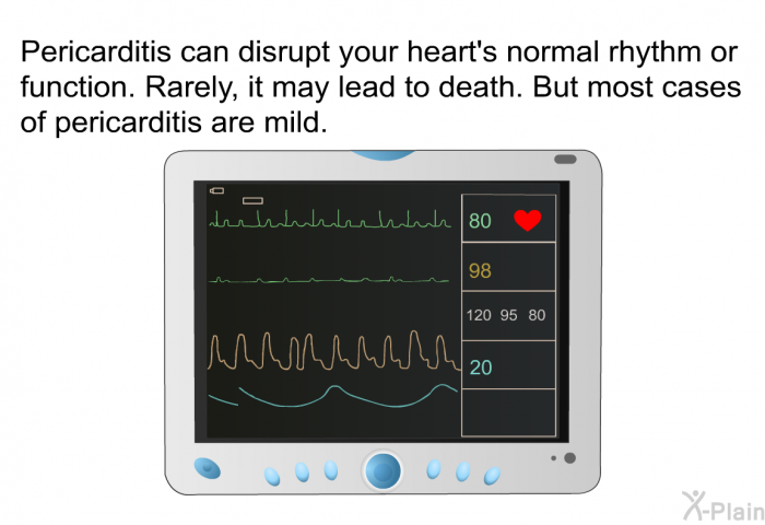 Pericarditis can disrupt your heart's normal rhythm or function. Rarely, it may lead to death. But most cases of pericarditis are mild.