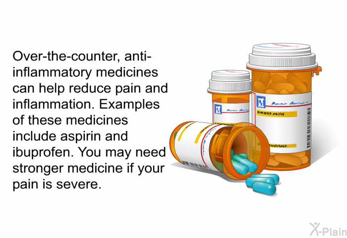 Over-the-counter, anti-inflammatory medicines can help reduce pain and inflammation. Examples of these medicines include aspirin and ibuprofen. You may need stronger medicine if your pain is severe.