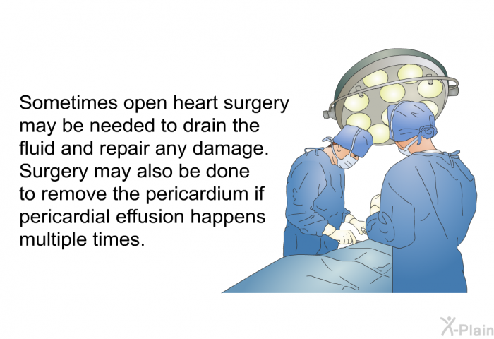Sometimes open heart surgery may be needed to drain the fluid and repair any damage. Surgery may also be done to remove the pericardium if pericardial effusion happens multiple times.