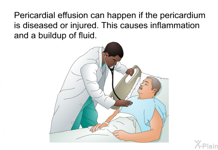 Pericardial effusion can happen if the pericardium is diseased or injured. This causes inflammation and a buildup of fluid.