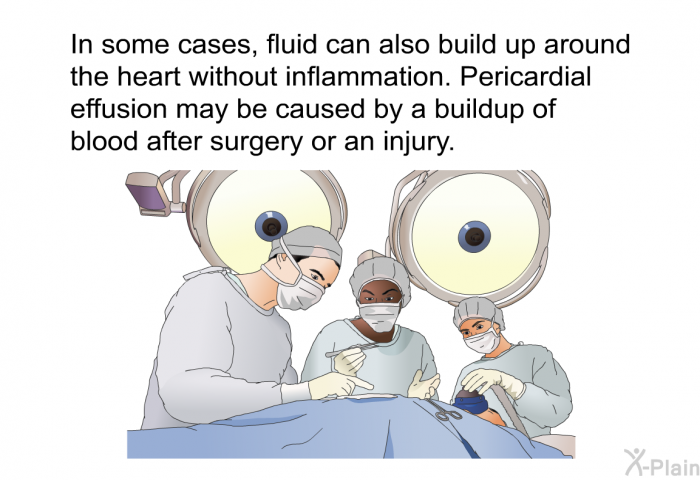 In some cases, fluid can also build up around the heart without inflammation. Pericardial effusion may be caused by a buildup of blood after surgery or an injury.