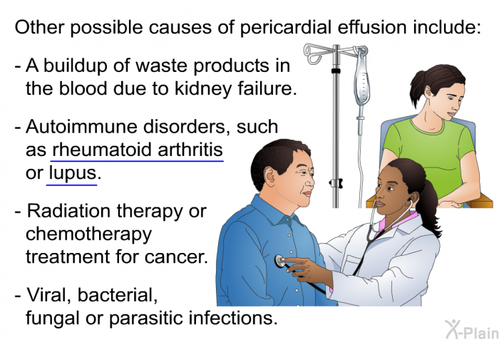 Other possible causes of pericardial effusion include:  A buildup of waste products in the blood due to kidney failure. Autoimmune disorders, such as rheumatoid arthritis or lupus. Radiation therapy or chemotherapy treatment for cancer. Viral, bacterial, fungal or parasitic infections.