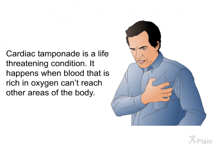 Cardiac tamponade is a life threatening condition. It happens when blood that is rich in oxygen can't reach other areas of the body.