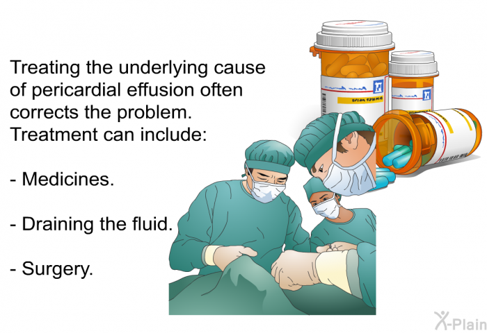 Treating the underlying cause of pericardial effusion often corrects the problem. Treatment can include:  Medicines. Draining the fluid. Surgery.