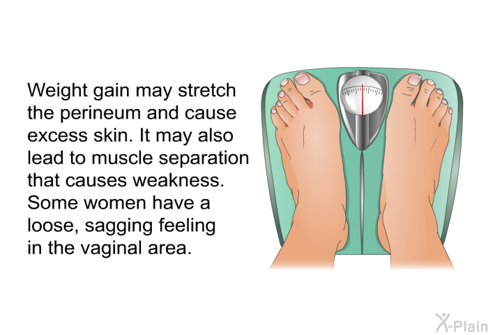 Weight gain may stretch the perineum and cause excess skin. It may also lead to muscle separation that causes weakness. Some women have a loose, sagging feeling in the vaginal area.