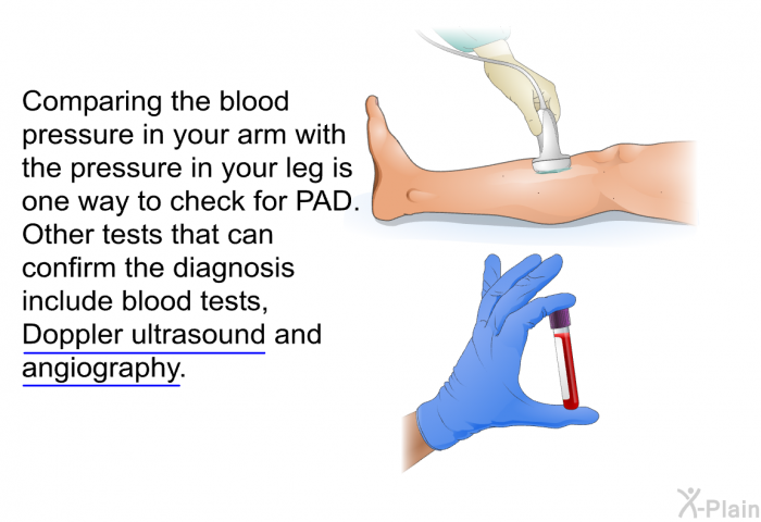 Comparing the blood pressure in your arm with the pressure in your leg is one way to check for PAD. Other tests that can confirm the diagnosis include blood tests, Doppler ultrasound and angiography.