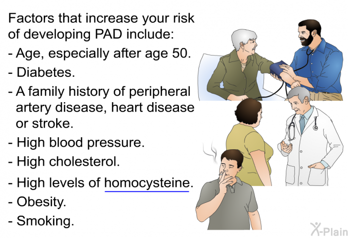 Factors that increase your risk of developing PAD include:  Age, especially after age 50. Diabetes. A family history of peripheral artery disease, heart disease or stroke. High blood pressure. High cholesterol. High levels of homocysteine. Homocysteine is a protein that helps build and maintain tissue.Obesity. Smoking.