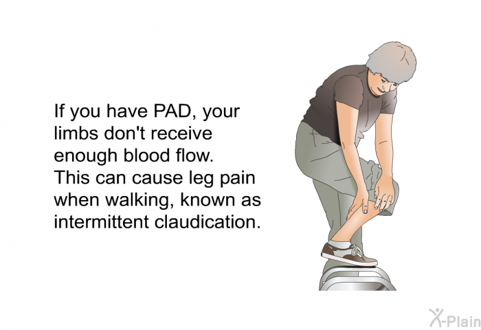 If you have PAD, your limbs don't receive enough blood flow. This can cause leg pain when walking, known as intermittent claudication.