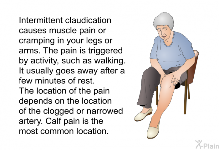 Intermittent claudication causes muscle pain or cramping in your legs or arms. The pain is triggered by activity, such as walking. It usually goes away after a few minutes of rest. The location of the pain depends on the location of the clogged or narrowed artery. Calf pain is the most common location.