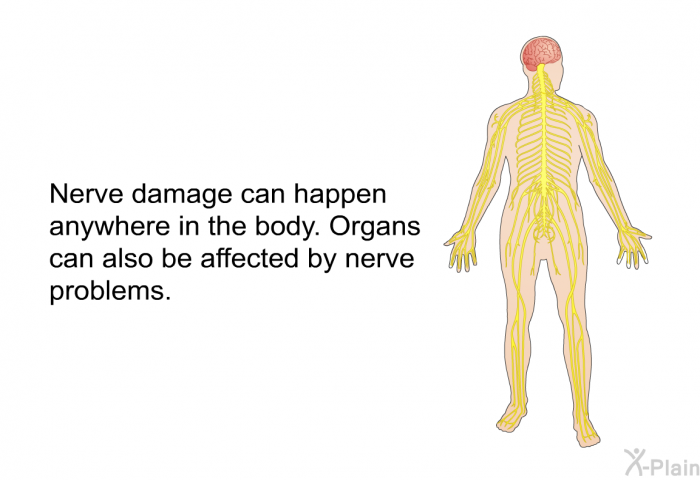 Nerve damage can happen anywhere in the body. Organs can also be affected by nerve problems.