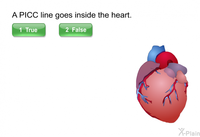 A PICC line goes inside the heart. Press True or False