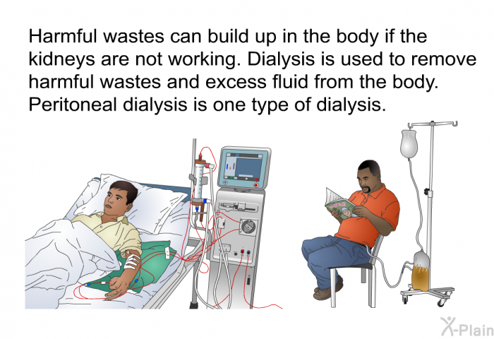 Harmful wastes can build up in the body if the kidneys are not working. Dialysis is used to remove harmful wastes and excess fluid from the body. Peritoneal dialysis is one type of dialysis.