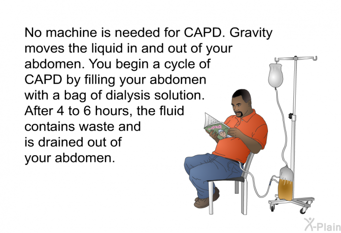 No machine is needed for CAPD. Gravity moves the liquid in and out of your abdomen. You begin a cycle of CAPD by filling your abdomen with a bag of dialysis solution. After 4 to 6 hours, the fluid contains waste and is drained out of your abdomen.