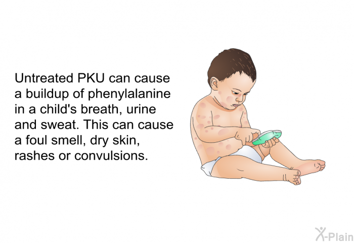 Untreated PKU can cause a buildup of phenylalanine in a child's breath, urine and sweat. This can cause a foul smell, dry skin, rashes or convulsions.