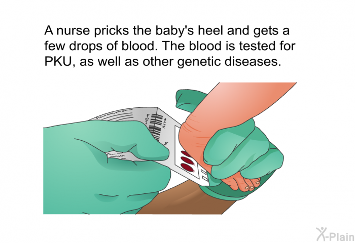 A nurse pricks the baby's heel and gets a few drops of blood. The blood is tested for PKU, as well as other genetic diseases.