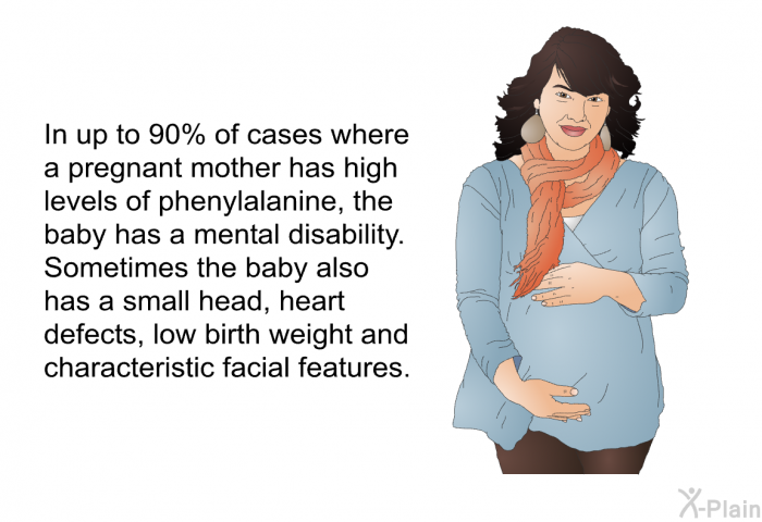 In up to 90% of cases where a pregnant mother has high levels of phenylalanine, the baby has a mental disability. Sometimes the baby also has a small head, heart defects, low birth weight and characteristic facial features.