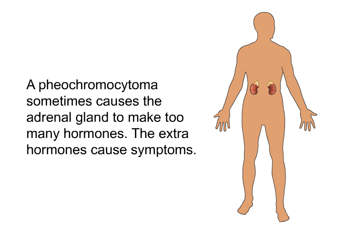A pheochromocytoma sometimes causes the adrenal gland to make too many hormones. The extra hormones cause symptoms.