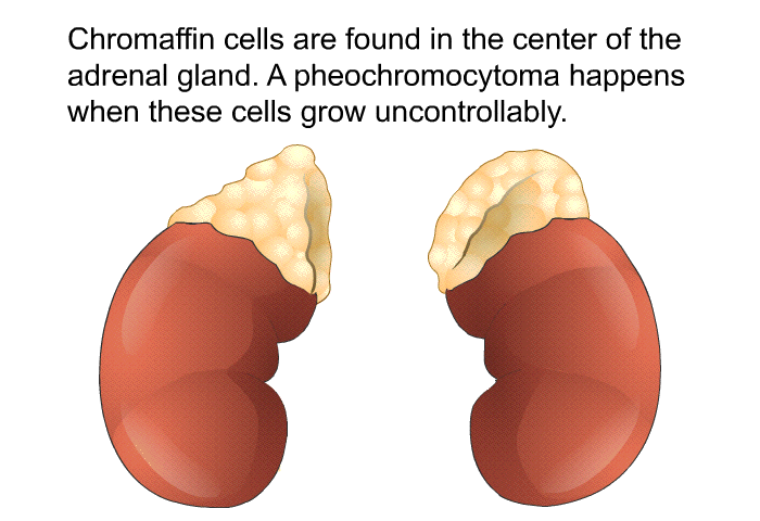 Chromaffin cells are found in the center of the adrenal gland. A pheochromocytoma happens when these cells grow uncontrollably.