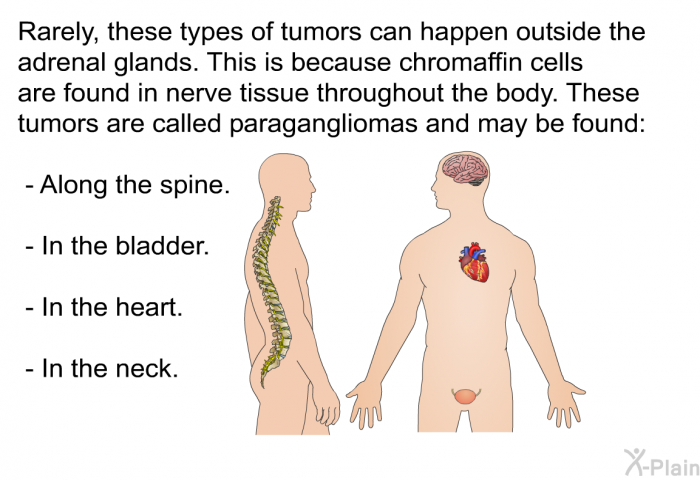 Rarely, these types of tumors can happen outside the adrenal glands. This is because chromaffin cells are found in nerve tissue throughout the body. These tumors are called paragangliomas and may be found:  Along the spine. In the bladder. In the heart. In the neck.