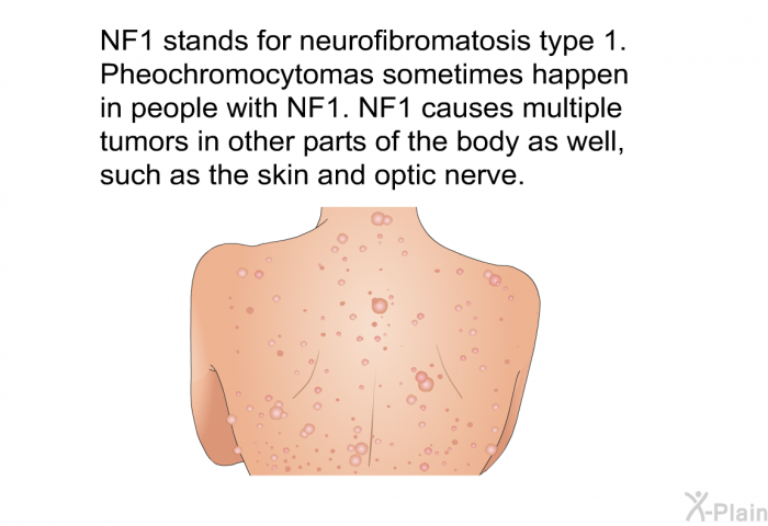 NF1 stands for neurofibromatosis type 1. Pheochromocytomas sometimes happen in people with NF1. NF1 causes multiple tumors in other parts of the body as well, such as the skin and optic nerve.