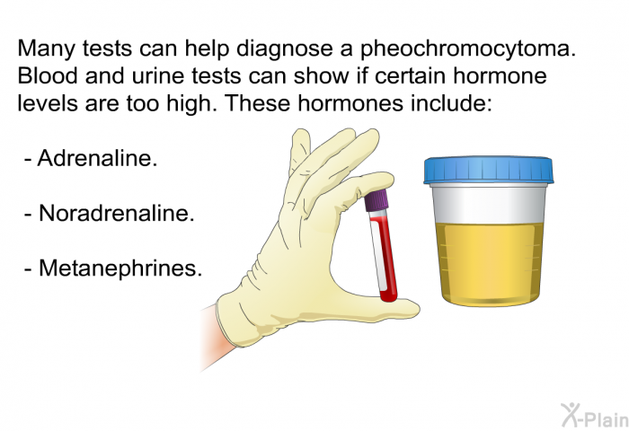 Many tests can help diagnose a pheochromocytoma. Blood and urine tests can show if certain hormone levels are too high. These hormones include:  Adrenaline. Noradrenaline. Metanephrines.