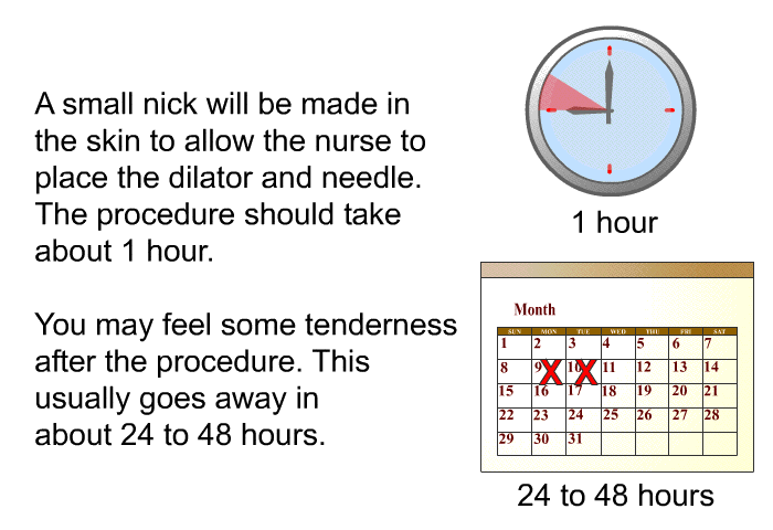 A small nick will be made in the skin to allow the nurse to place the dilator and needle. The procedure should take about 1 hour.

 You may feel some tenderness after the procedure. This usually goes away in about 24 to 48 hours.