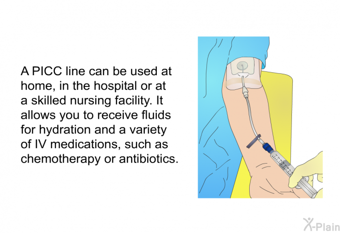 A PICC line can be used at home, in the hospital or at a skilled nursing facility. It allows you to receive fluids for hydration and a variety of IV medications, such as chemotherapy or antibiotics.