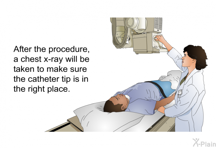 After the procedure, a chest x-ray will be taken to make sure the catheter tip is in the right place.