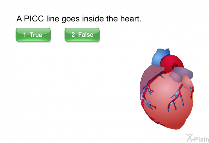 A PICC line goes inside the heart.