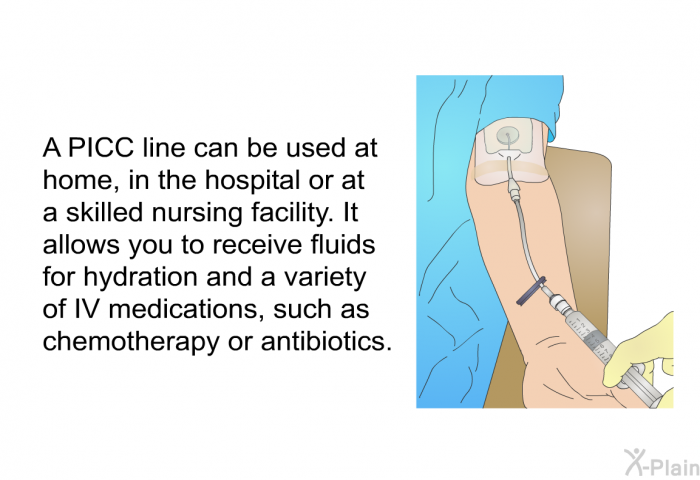 A PICC line can be used at home, in the hospital or at a skilled nursing facility. It allows you to receive fluids for hydration and a variety of IV medications, such as chemotherapy or antibiotics.